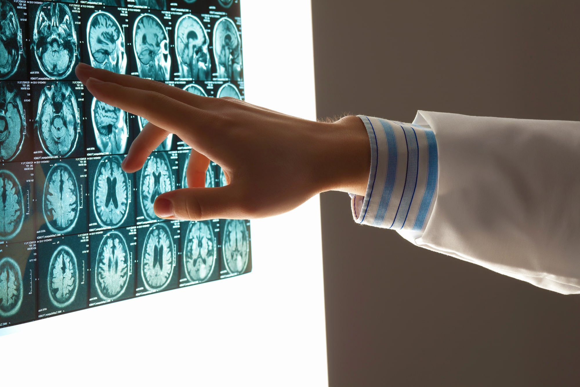 brain injury lawyer Baton Rouge, LA
