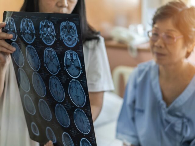 The Real Cost Of Living With A Traumatic Brain Injury