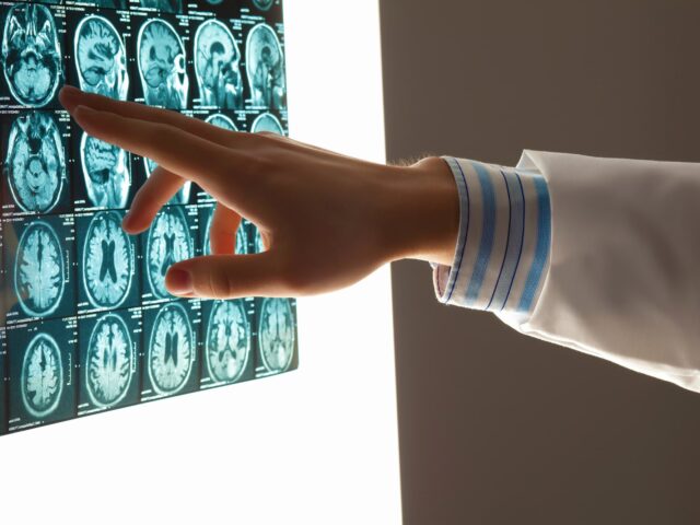 Brain Injuries And Emotional Changes