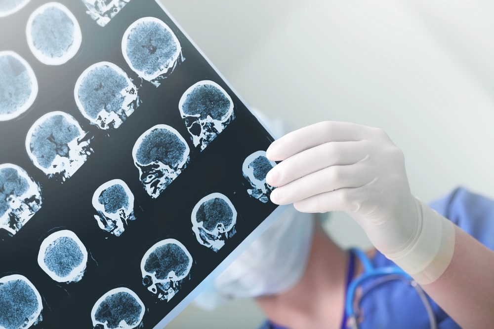 brain injury lawyer in Baton Rouge, LA