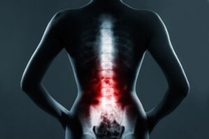 back injury lawyer Baton Rouge LA